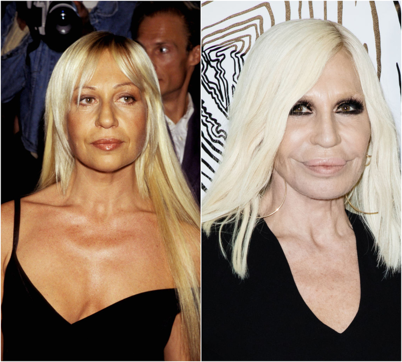 Donatella Versace – (Rumored) $25,000 | Getty Images Photo by Ron Galella & Rosdiana Ciaravolo