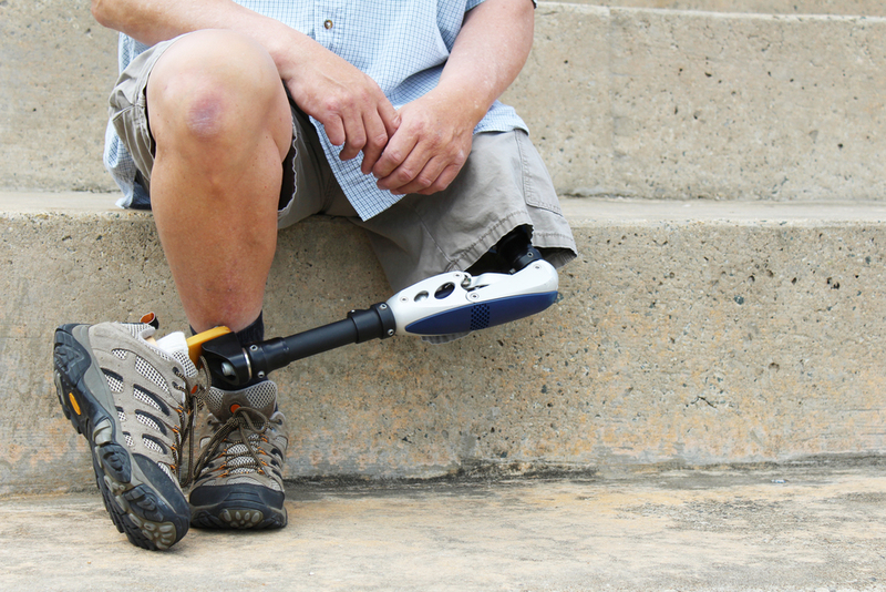 Prosthetic Help | Shutterstock