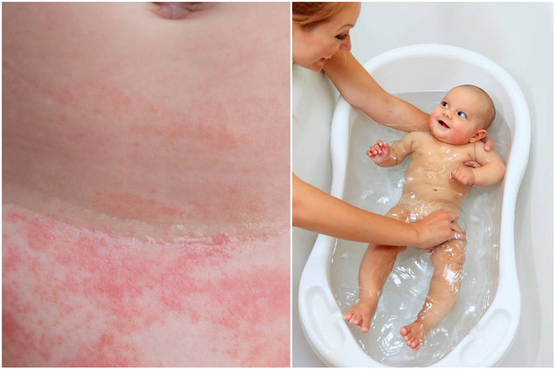 Relieve Diaper Rash | lavizzara/Shutterstock & Photobac/Shutterstock