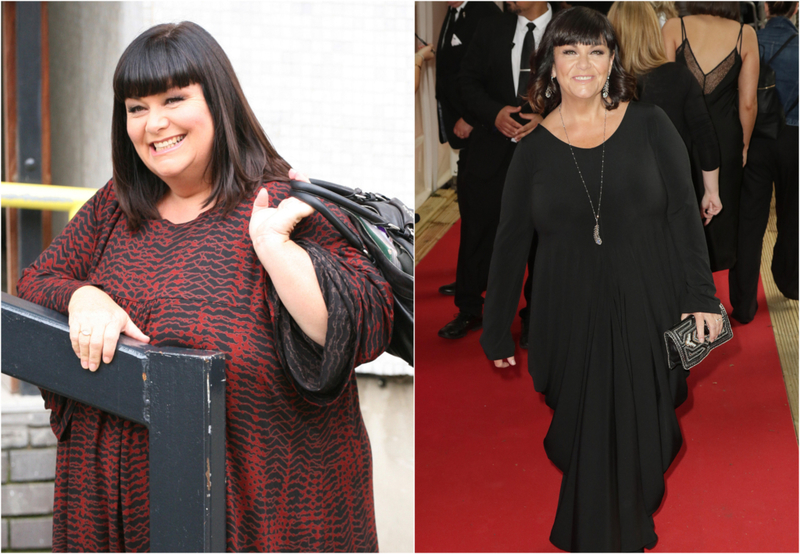 Dawn French - 98 Pounds | Alamy Stock Photo