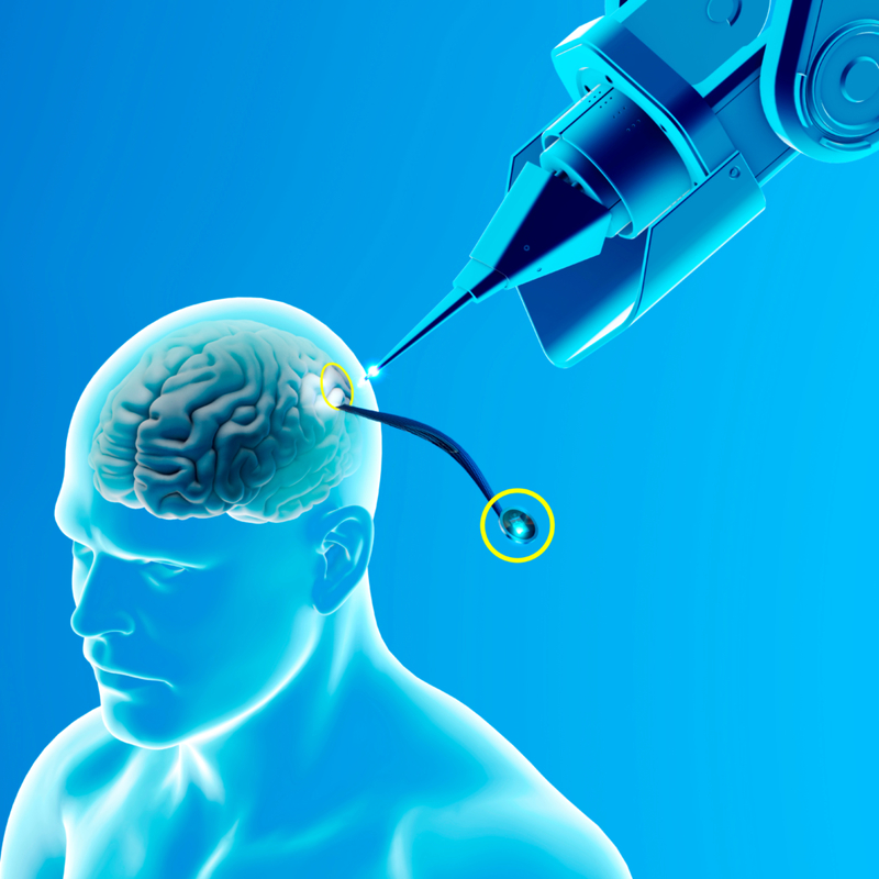 Neuralink | Naeblys/Shutterstock