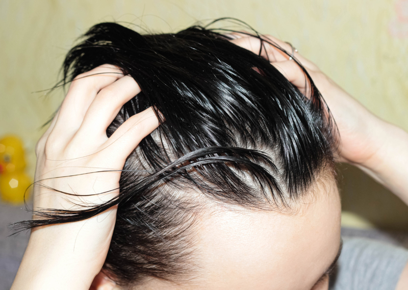 Dandruff Treatment | Shutterstock