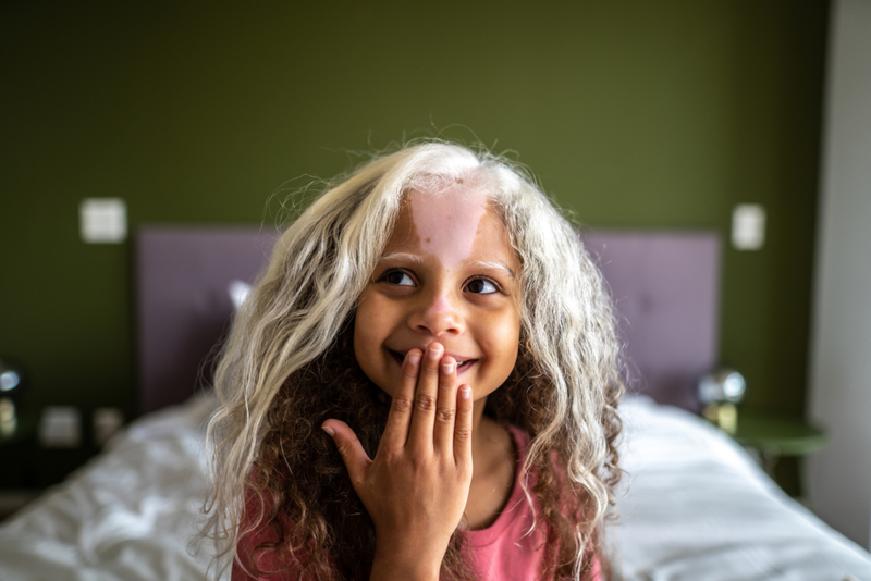 A Shock of White Hair | Getty Images Photo by FG Trade