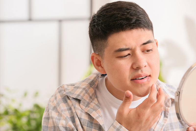 Conquer Cold Sores | Shutterstock Photo by Pixel-Shot