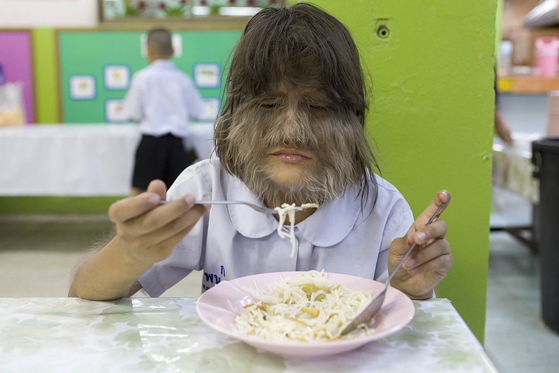 Willst du mehr Haare? Alles klar | Getty Images Photo by Bronek Kaminski/Barcroft Media