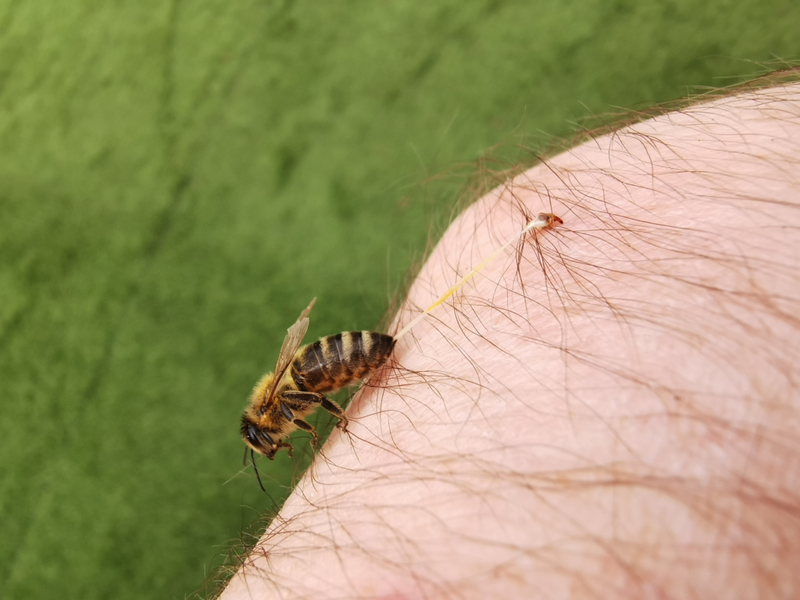 Deadly Bee Sting | Shutterstock