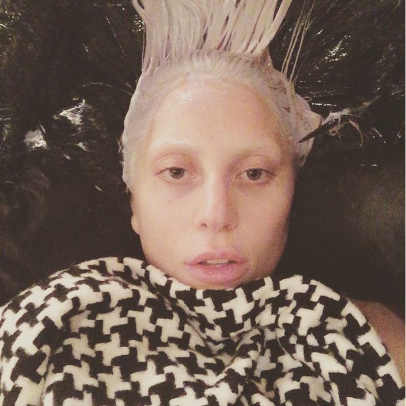 Problemas capilares | Instagram/@ladygaga