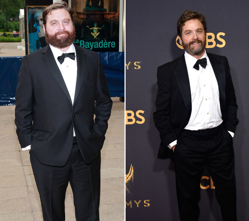 Zach Galifianakis - 23 Kg | Getty Images Photo by Charles Eshelman/FilmMagic & Frazer Harrison