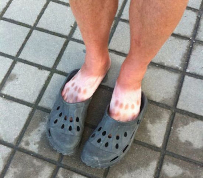 Crocs Alptraum | Imgur.com/elSuV