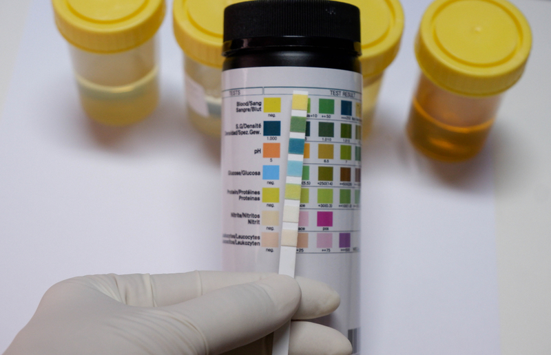 Keep Your Urinary Tract at the Proper pH | Shutterstock