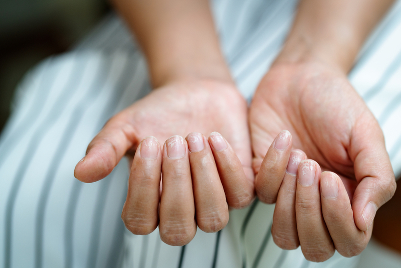 Keep Nails White and Clean | Shutterstock