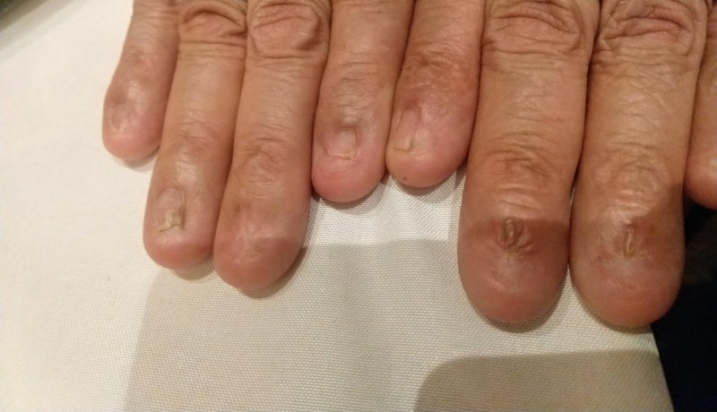 Ei, Não Precisar Se Preocupar em Cortas as Unhas | Reddit.com/howtofax