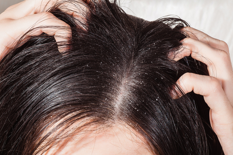 Scalp Salve | Shutterstock