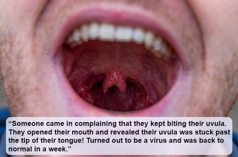 The Dangly Thing in the Back of Your Mouth | sunakri/Shutterstock