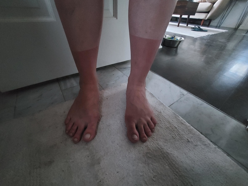 A Pair of Sunburn Socks | Reddit.com/indysleep